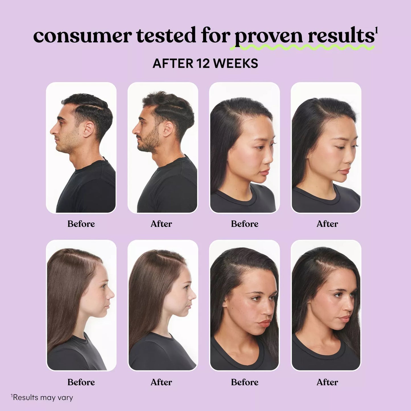 Lemme Grow – Hair Growth Supplement (1 Month Supply)