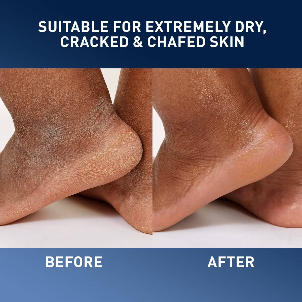 CeraVe – Healing Ointment Skin Protectant (12 oz)