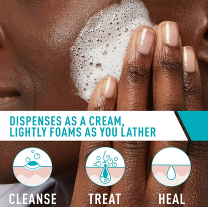 Acne Foaming Cream Cleanser